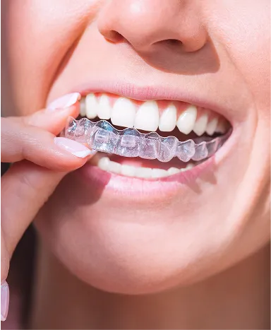 Invisalign